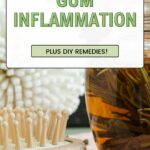 Herbs For Gum Inflammation