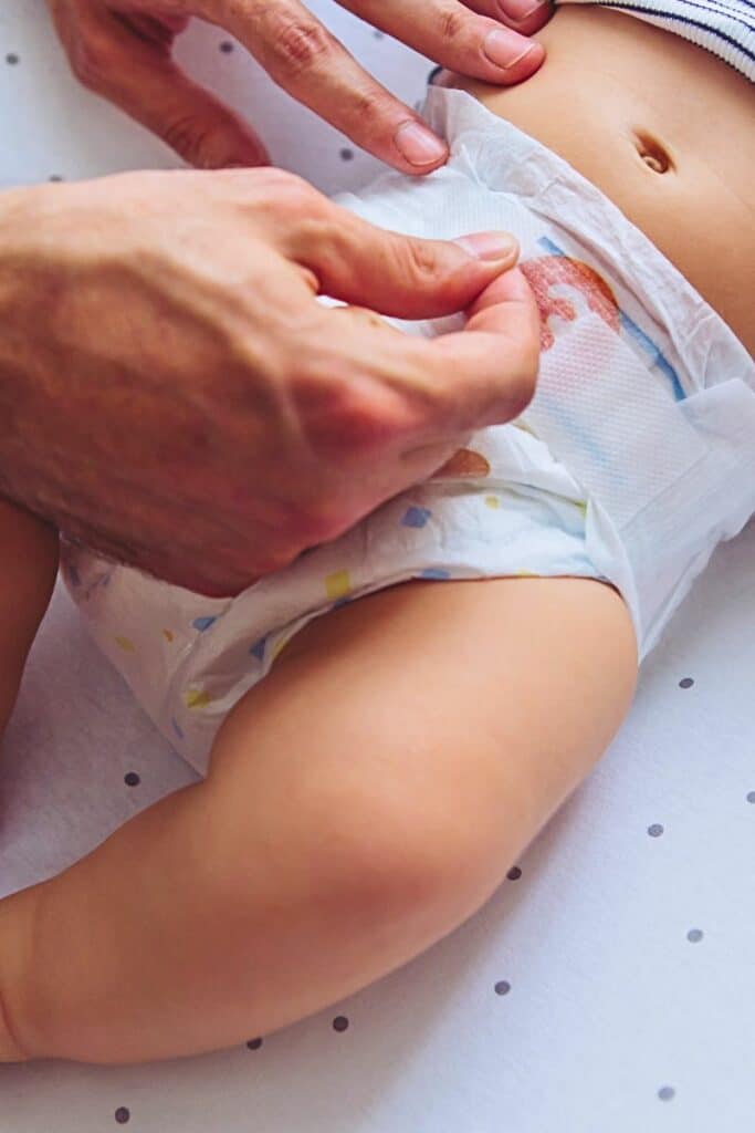 how to prevent Diaper Rashes