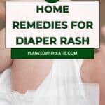 home remedies for diaper rash