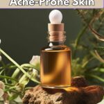 best natural facial moisturizer for acne prone skin